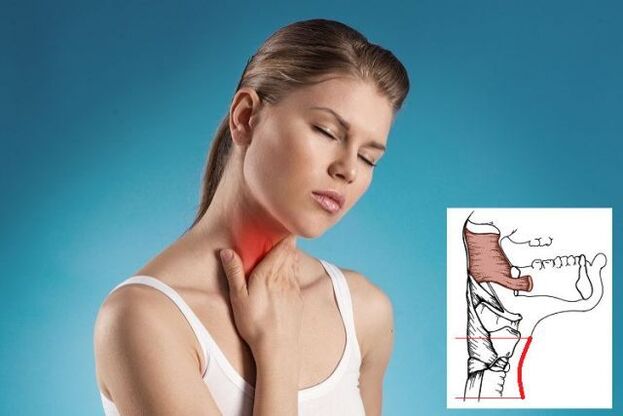 dor de garganta com osteocondrose cervical
