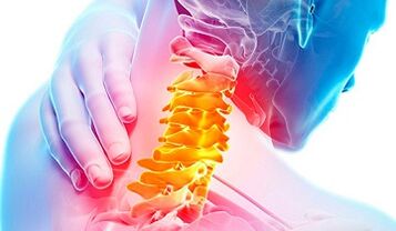 Sinais de osteocondrose da coluna cervical