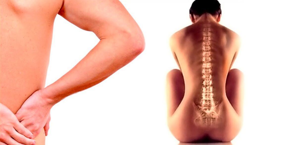 dor lombar devido à osteocondrose