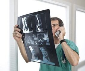 Mielografia para diagnóstico de osteocondrose e hérnias intervertebrais