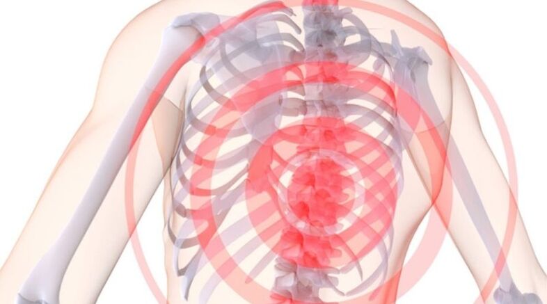 Osteocondrose da coluna